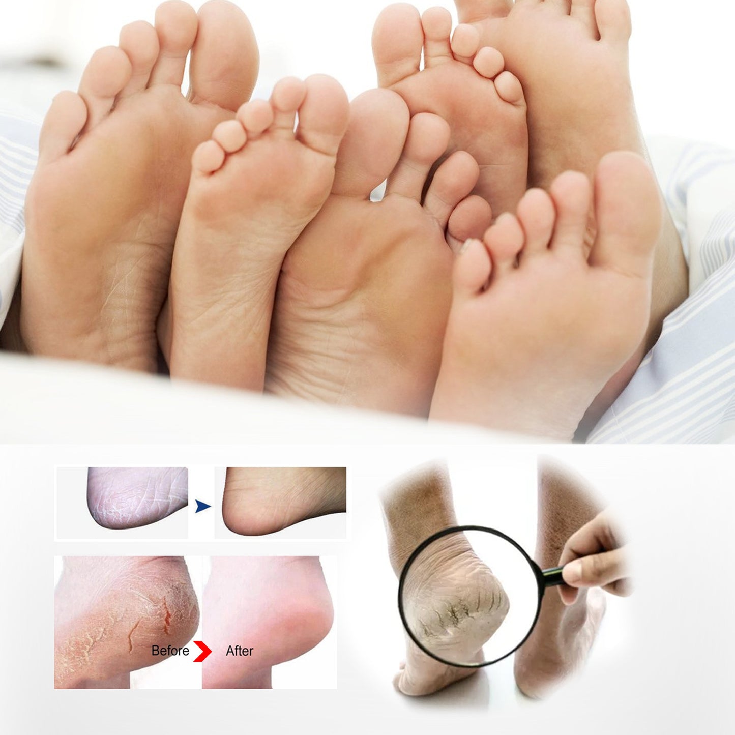 Foot Anti-Fungal Spray