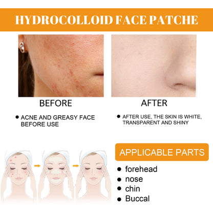 EELHOE Hydrogel Facial Acne Patch