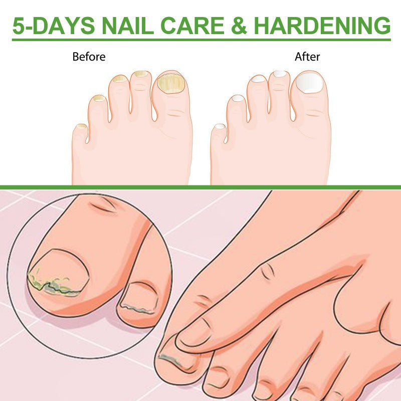 5-Days Nail Care And Hardening Repair Roller